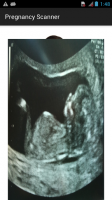 Pregnancy Xray Scanner Prank for PC