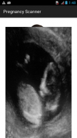 Pregnancy Xray Scanner Prank for PC